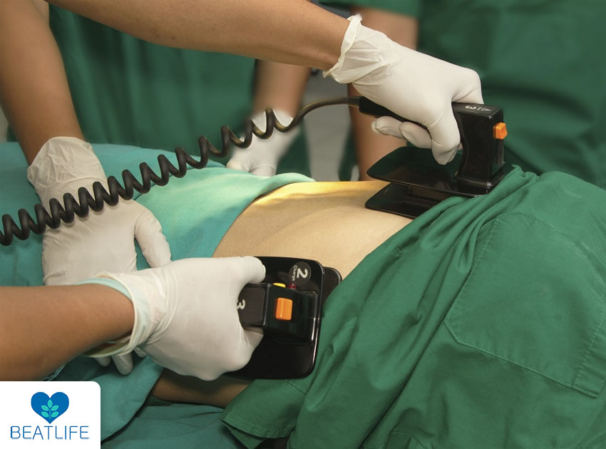Why Is Defibrillation Important in BLS?