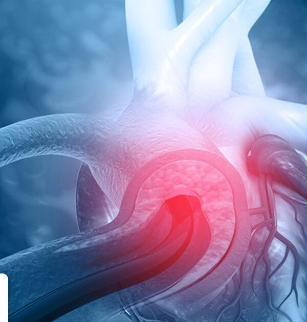 What is Cardiac Arrhythmia?